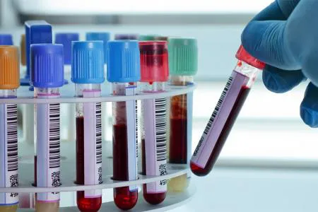 bioquimicos_iosper