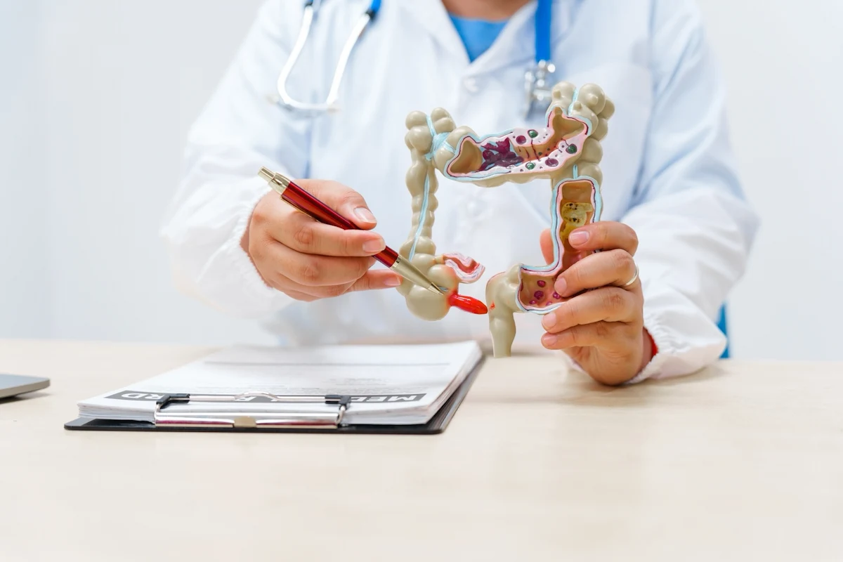 cancer-colon- lalcec - diario el enfoque concordia