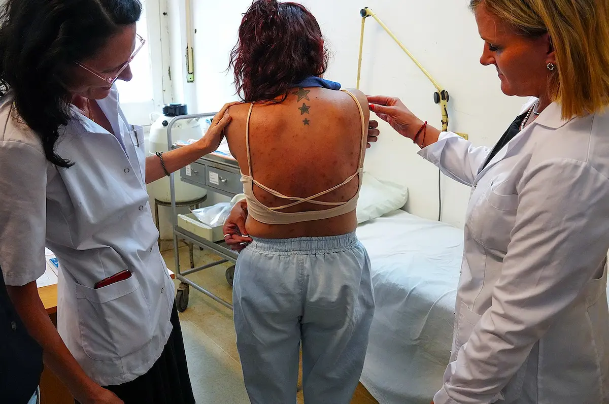 Dermatitis atópica - Diario El Enfoque Concordia